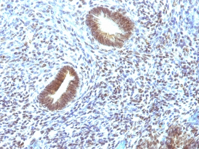 Monoclonal Antibody to MAP3K1 (Mitogen-Activated Protein Kinase Kinase Kinase 1)(Clone : 2F6)