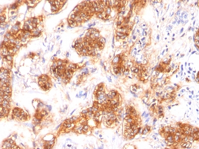 Monoclonal Antibody to Milk Fat Globule (Breast Epithelial Marker)(Clone : SPM291)