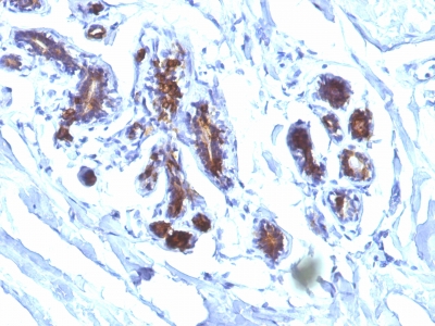 Monoclonal Antibody to Milk Fat Globule (Breast Epithelial Marker)(Clone : EDM45)