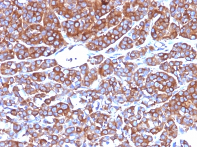 Monoclonal Antibody to Moesin(Clone : MSN/492)