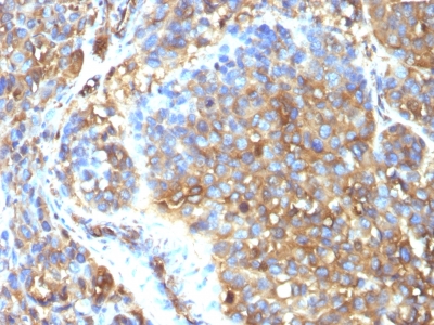 Monoclonal Antibody to Moesin(Clone : MSN/493)