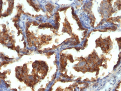 Monoclonal Antibody to MUC1 / EMA / CD227 (Epithelial Marker)(Clone : MUC1/955)