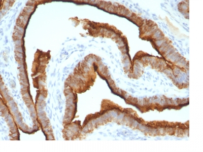 Monoclonal Antibody to MUC1 / EMA / CD227 (Epithelial Marker)(Clone : MUC1/967)