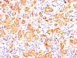 Monoclonal Antibody to MUC1 / EMA / CD227 (Epithelial Marker)(Clone : GP1.4)