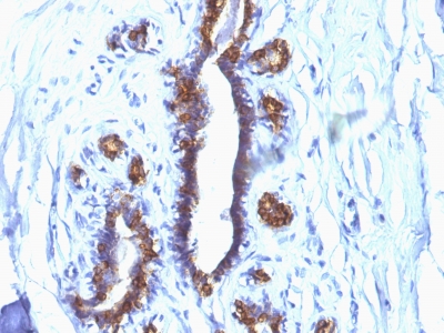 Monoclonal Antibody to MUC1 / EMA / CD227 (Epithelial Marker)(Clone : SPM132)