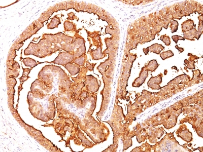 Monoclonal Antibody to MUC1 / EMA / CD227 (Epithelial Marker)(Clone : E29)