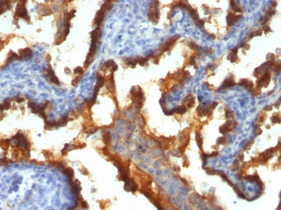 Monoclonal Antibody to MUC1 / EMA / CD227 (Epithelial Marker)(Clone : 139H2)