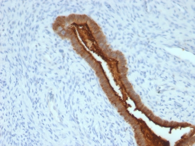 Monoclonal Antibody to MUC1 / EMA / CD227 (Epithelial Marker)(Clone : SPM492)