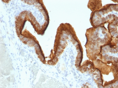 Monoclonal Antibody to MUC1 / EMA / CD227 (Epithelial Marker)(Clone : SPM493)