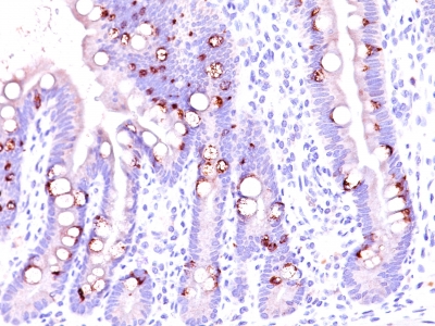 Monoclonal Antibody to MUC2 (Mucin 2)(Clone : CCP58)