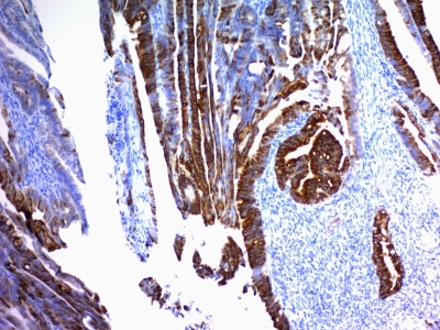 Monoclonal Antibody to MUC2 (Mucin 2)(Clone : SPM296)