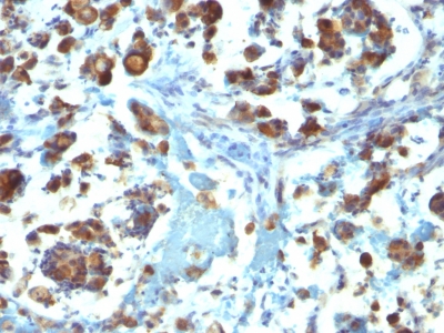 Monoclonal Antibody to MUC3 (Mucin 3)(Clone : M3.1)