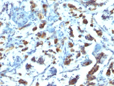 Monoclonal Antibody to MUC3 (Mucin 3)(Clone : SPM200)