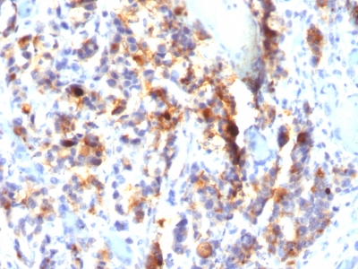 Monoclonal Antibody to MUC5AC (Mucin 5AC / Gastric Mucin)(Clone : SPM297)