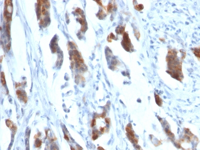 Monoclonal Antibody to MUC5AC (Mucin 5AC / Gastric Mucin)(Clone : 58M1)