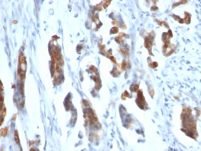 Monoclonal Antibody to MUC5AC (Mucin 5AC / Gastric Mucin)(Clone : CLH2)