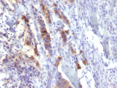 Monoclonal Antibody to MUC5AC (Mucin 5AC / Gastric Mucin)(Clone : SPM488)