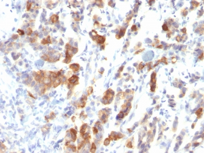 Monoclonal Antibody to MUC5AC (Mucin 5AC / Gastric Mucin)(Clone : MUC5AC/917)