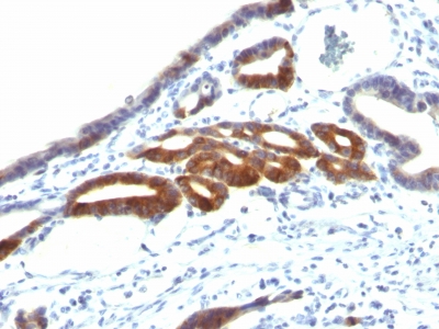 Monoclonal Antibody to MUC6 (Mucin 6 / Gastric Mucin)(Clone : SPM598)