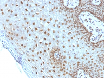 Monoclonal Antibody to c-Myc Oncoprotein(Clone : MYC275)