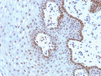 Monoclonal Antibody to c-Myc Oncoprotein(Clone : 9E10.3)