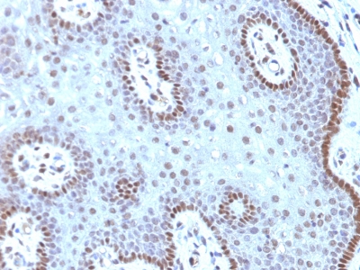 Monoclonal Antibody to c-Myc Oncoprotein(Clone : MYC909)