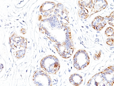 Monoclonal Antibody to Smooth Muscle Myosin Heavy Chain (SM-MHC) (Leiomyosarcoma & Myoepithelial Cell Marker)