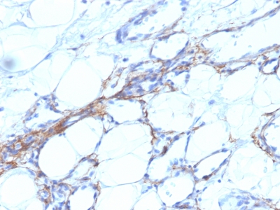 Monoclonal Antibody to Smooth Muscle Myosin Heavy Chain (SM-MHC) (Leiomyosarcoma & Myoepithelial Cell Marker)