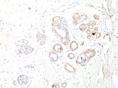 Monoclonal Antibody to Smooth Muscle Myosin Heavy Chain (SM-MHC) (Leiomyosarcoma & Myoepithelial Cell Marker)