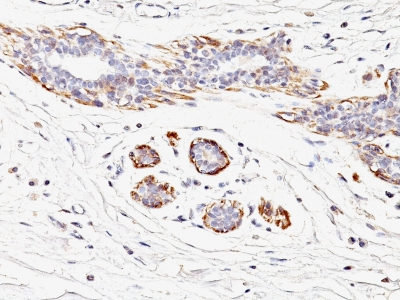 Monoclonal Antibody to Smooth Muscle Myosin Heavy Chain (SM-MHC) (Leiomyosarcoma & Myoepithelial Cell Marker)