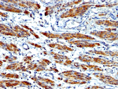 Monoclonal Antibody to Smooth Muscle Myosin Heavy Chain (SM-MHC) (Leiomyosarcoma & Myoepithelial Cell Marker)