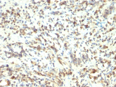 Monoclonal Antibody to MyoD1 (Rhabdomyosarcoma Marker)(Clone : 5.8A)(Discontinued)