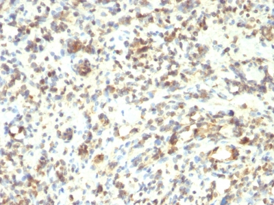 Monoclonal Antibody to MyoD1 (Rhabdomyosarcoma Marker)(5.8A + MYD712)(Discontinued)