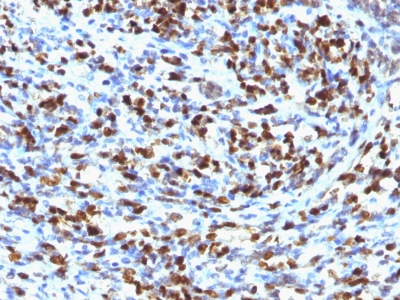 Monoclonal Antibody to Myogenin (Skeletal Muscle Marker)(Clone : MGN185)