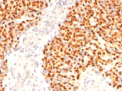 Monoclonal Antibody to Myogenin (Skeletal Muscle Marker)(Clone : F5D)