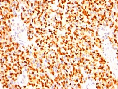 Monoclonal Antibody to Myogenin (Skeletal Muscle Marker)(Clone : SPM144)