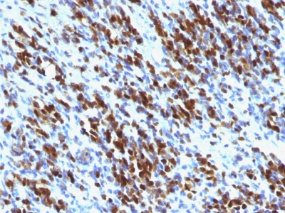 Monoclonal Antibody to Myogenin (Skeletal Muscle Marker)(MGN185 + F5D)