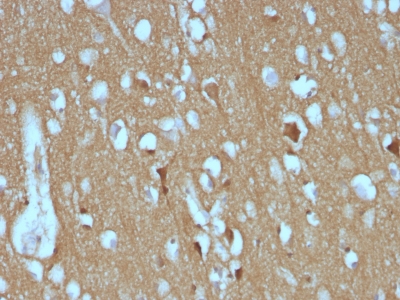 Monoclonal Antibody to CD56 / NCAM1 (Neuronal Cell Marker)(Clone : SPM128)