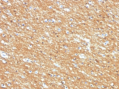 Monoclonal Antibody to CD56 / NCAM1 / NKH1 (Neuronal Cell Marker)(Clone : 123A8; same 56C04)