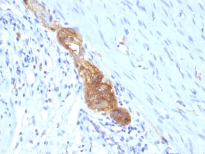 Monoclonal Antibody to CD56 / NCAM1 / NKH1 (Neuronal Cell Marker)(Clone : SPM489)