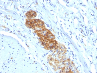 Monoclonal Antibody to CD56 / NCAM1 / NKH1 (Neuronal Cell Marker)(Clone : NCAM1/784)