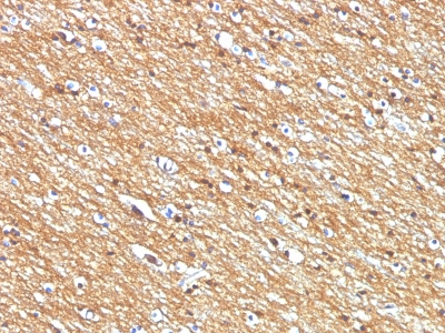 Monoclonal Antibody to CD56 / NCAM1 / NKH1 (Neuronal Cell Marker)(Clone : NCAM1/795)