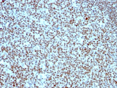 Monoclonal Antibody to Nucleolin (Marker of Human Cells)(Clone : SPM614)(Clone : SPM614)