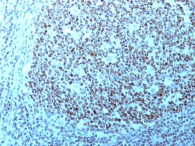 Monoclonal Antibody to Nucleolin (Marker of Human Cells)(364-5 + NCL/902)