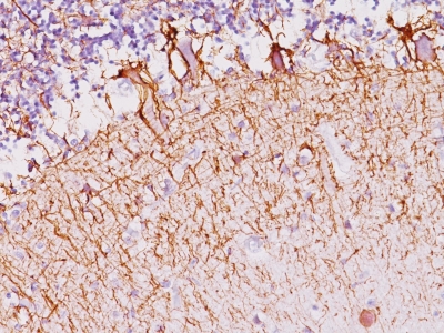 Monoclonal Antibody to Neurofilament (NF-H) (Neuronal Marker)(Clone : NF421)