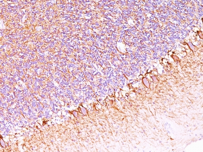 Monoclonal Antibody to Neurofilament (NF-H) (Neuronal Marker)(Clone : SPM563)