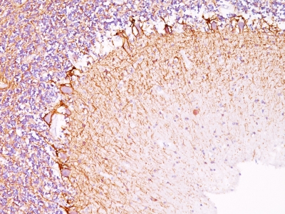 Monoclonal Antibody to Neurofilament (NF-H) (Neuronal Marker)(Clone : RT97)