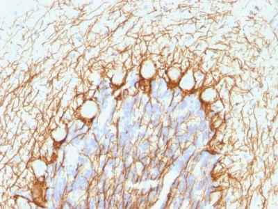 Monoclonal Antibody to Neurofilament, phospho (NF-H) (Neuronal Marker)(Clone : NE14)