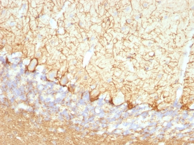 Monoclonal Antibody to Neurofilament (NF-L) (Neuronal Marker)(Clone : NFL/736)