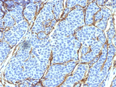 Monoclonal Antibody to NGF-Receptor (p75) / CD271 (Soft Tissue Tumor Marker)(Clone : SPM299)